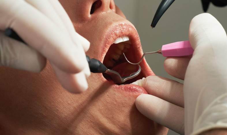 Czym jest dentofobia?